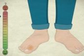 Ayak Parmağının Kırıldığı Nasıl Anlaşılır?